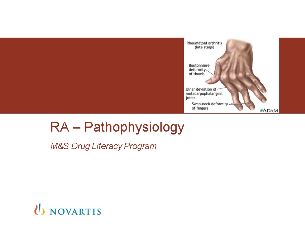 M&S Drug Literacy Program RA – Pathophysiology